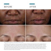 SkinCeuticals Cell Cycle Catalyst 30ml